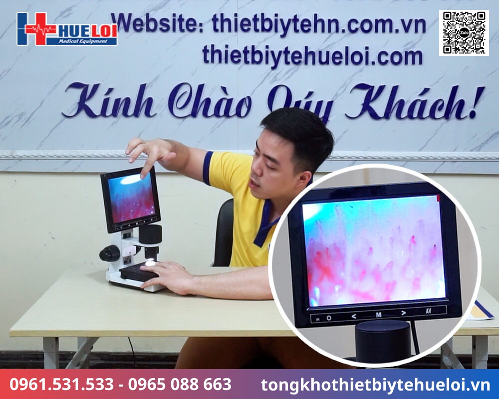 kính hiển vi soi mạch máu