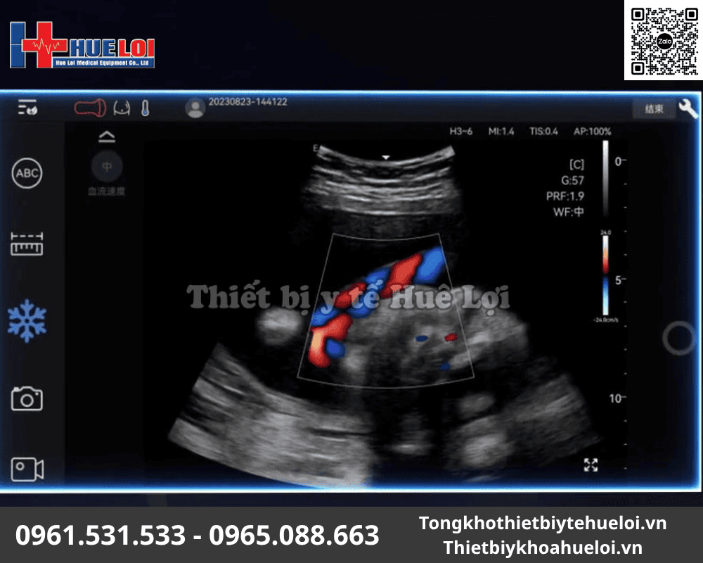 siêu âm xương khớp