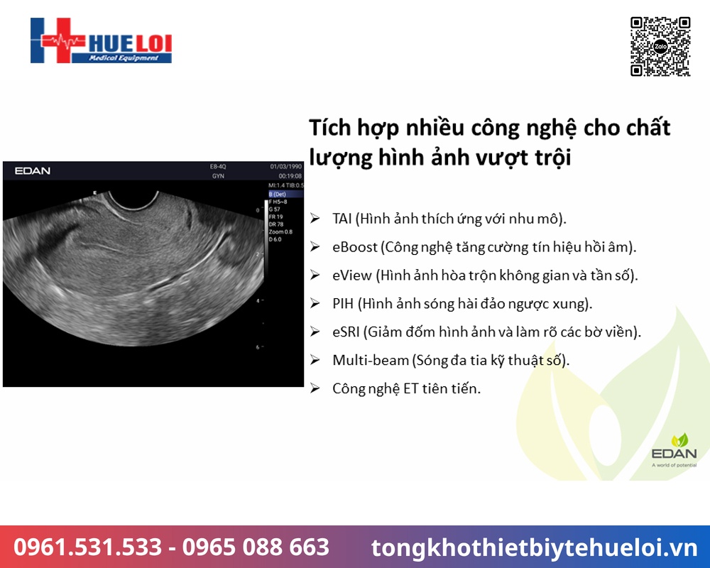 chất lượng hình ảnh siêu âm