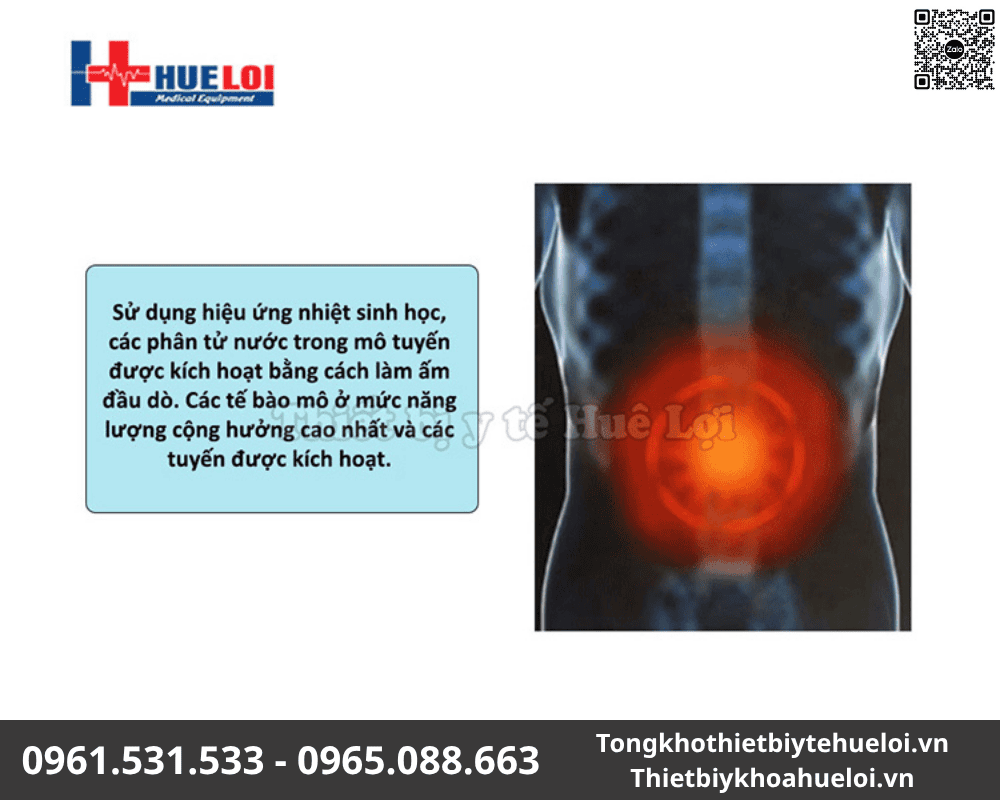 máy tuyến tiền liệt giá rẻ