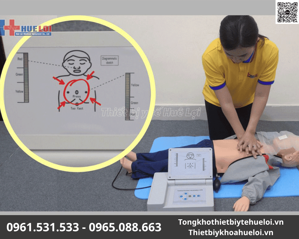 mô hình cấp cứu trẻ