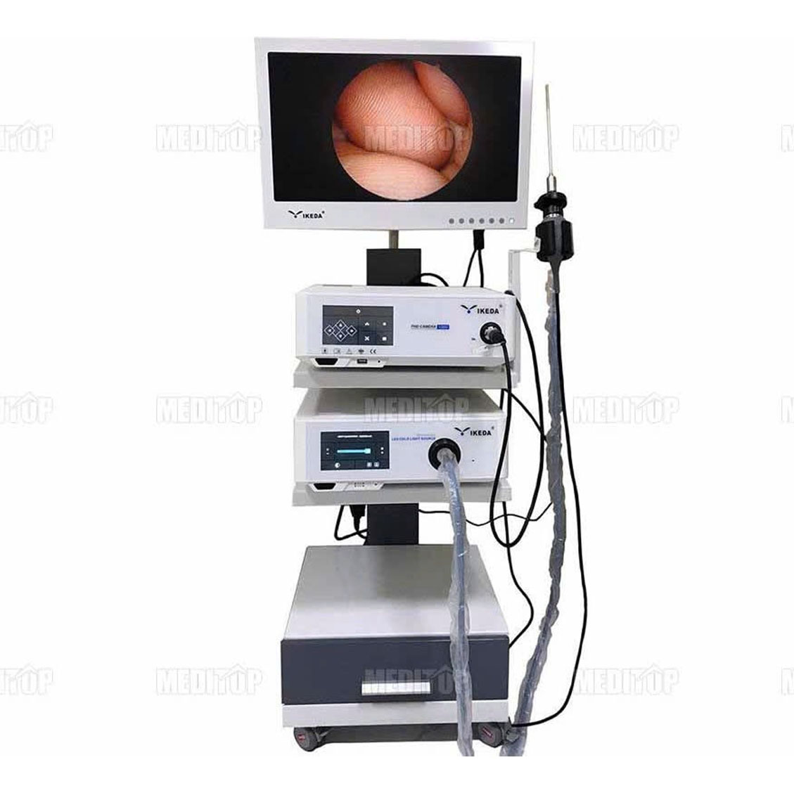 Máy nội soi tai mũi họng
