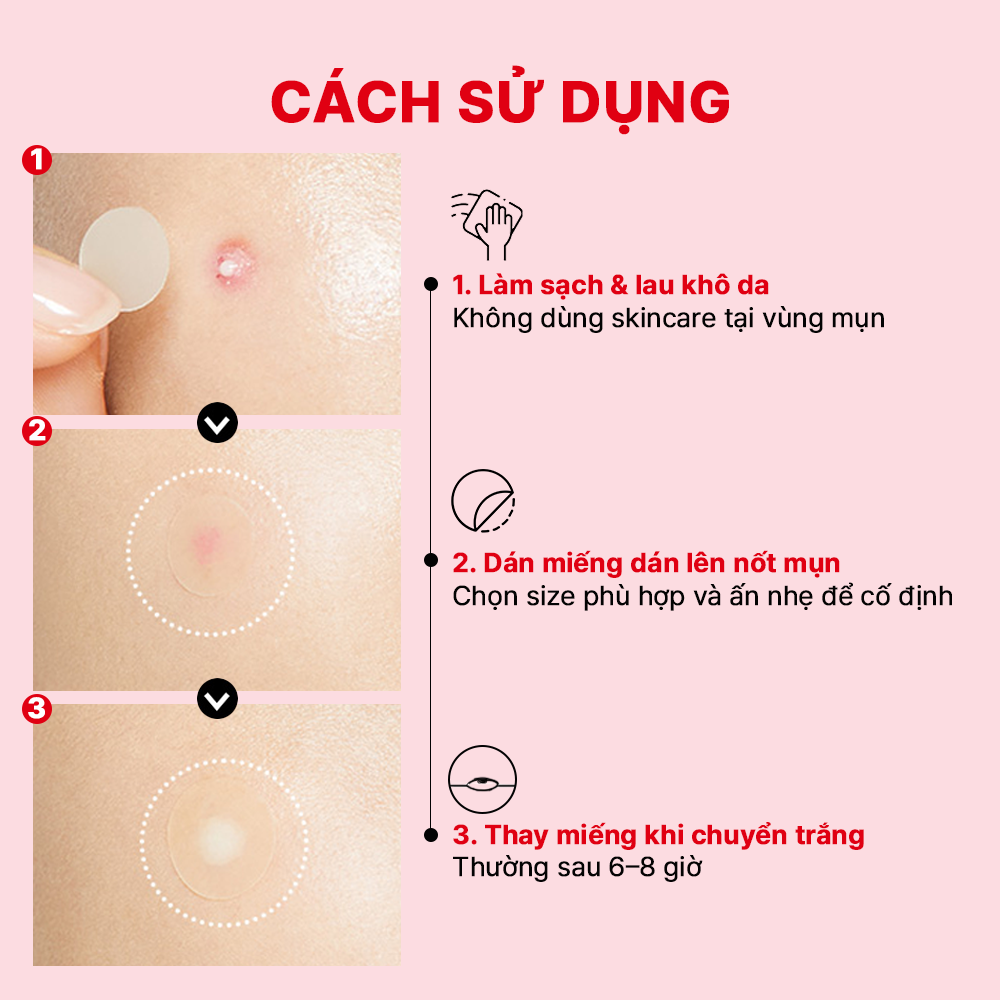 Miếng dán mụn Cosrx Master Patch Original Fit (24 miếng)