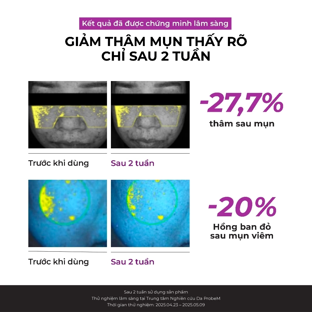 Tinh chất dưỡng sáng, mờ thâm Jumiso Niacinamide Serum 40ml