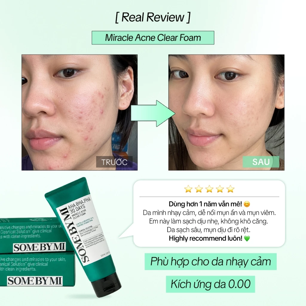 Sữa rửa mặt Some By Mi AHA-BHA-PHA 30 Days Miracle Acne Clear Foam 100ml