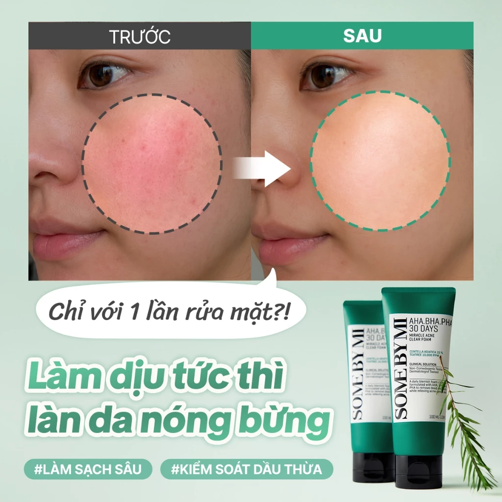 Sữa rửa mặt Some By Mi AHA-BHA-PHA 30 Days Miracle Acne Clear Foam 100ml