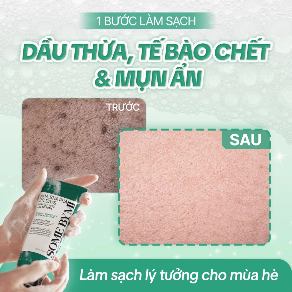 Sữa rửa mặt Some By Mi AHA-BHA-PHA 30 Days Miracle Acne Clear Foam 100ml