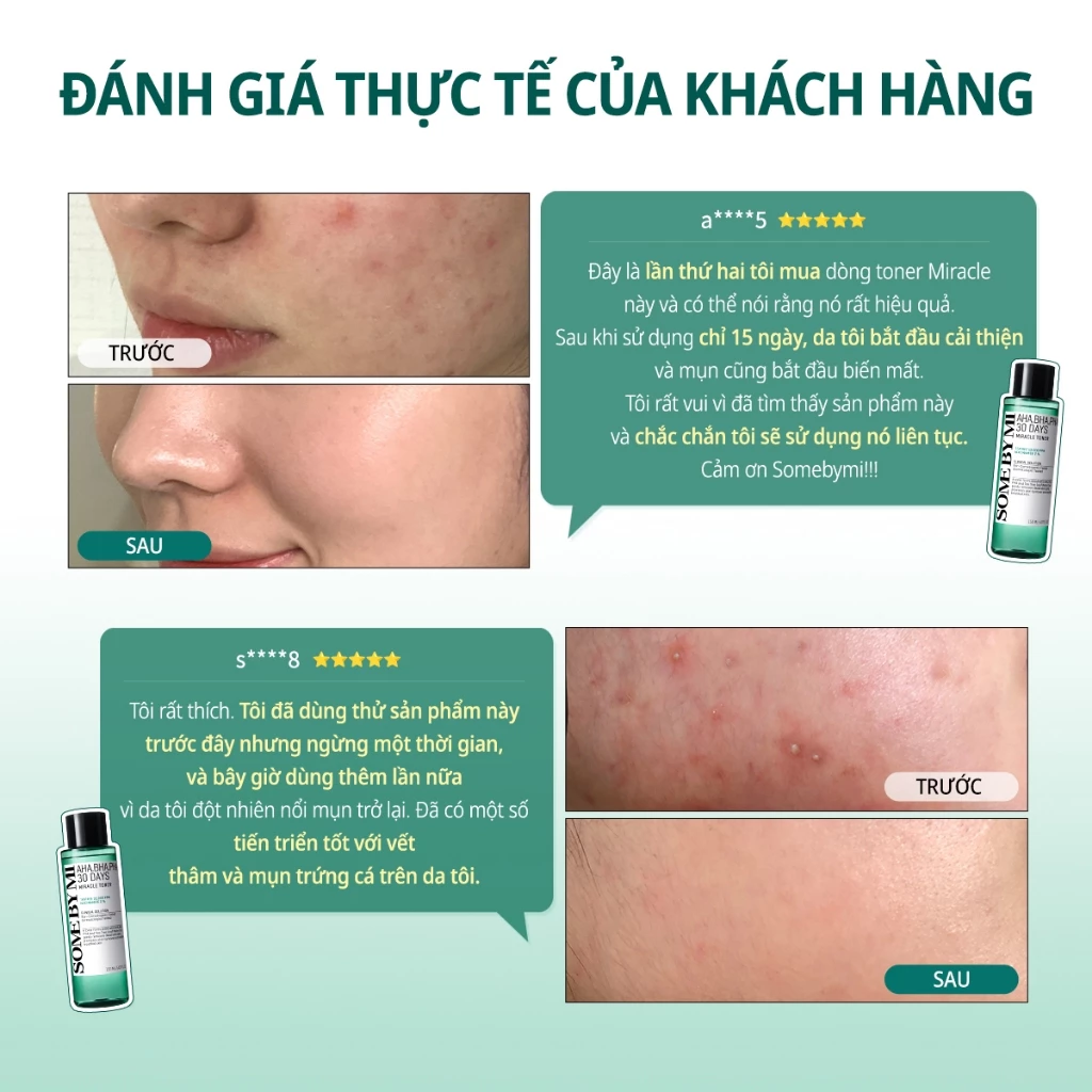 Nước hoa hồng Some By Mi AHA-BHA-PHA 30 Days Miracle Toner 150ml
