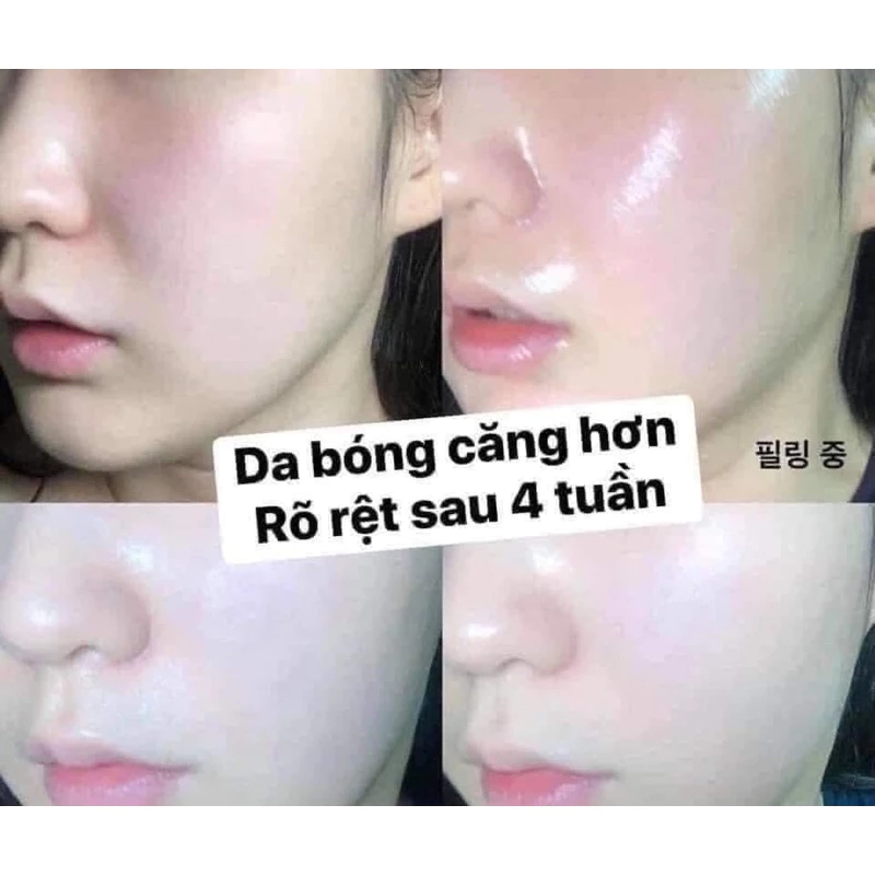 Tẩy Tế Bào Chết Hóa Học Dạng Gel CNP Laboratory Invisible Peeling Booster Essence