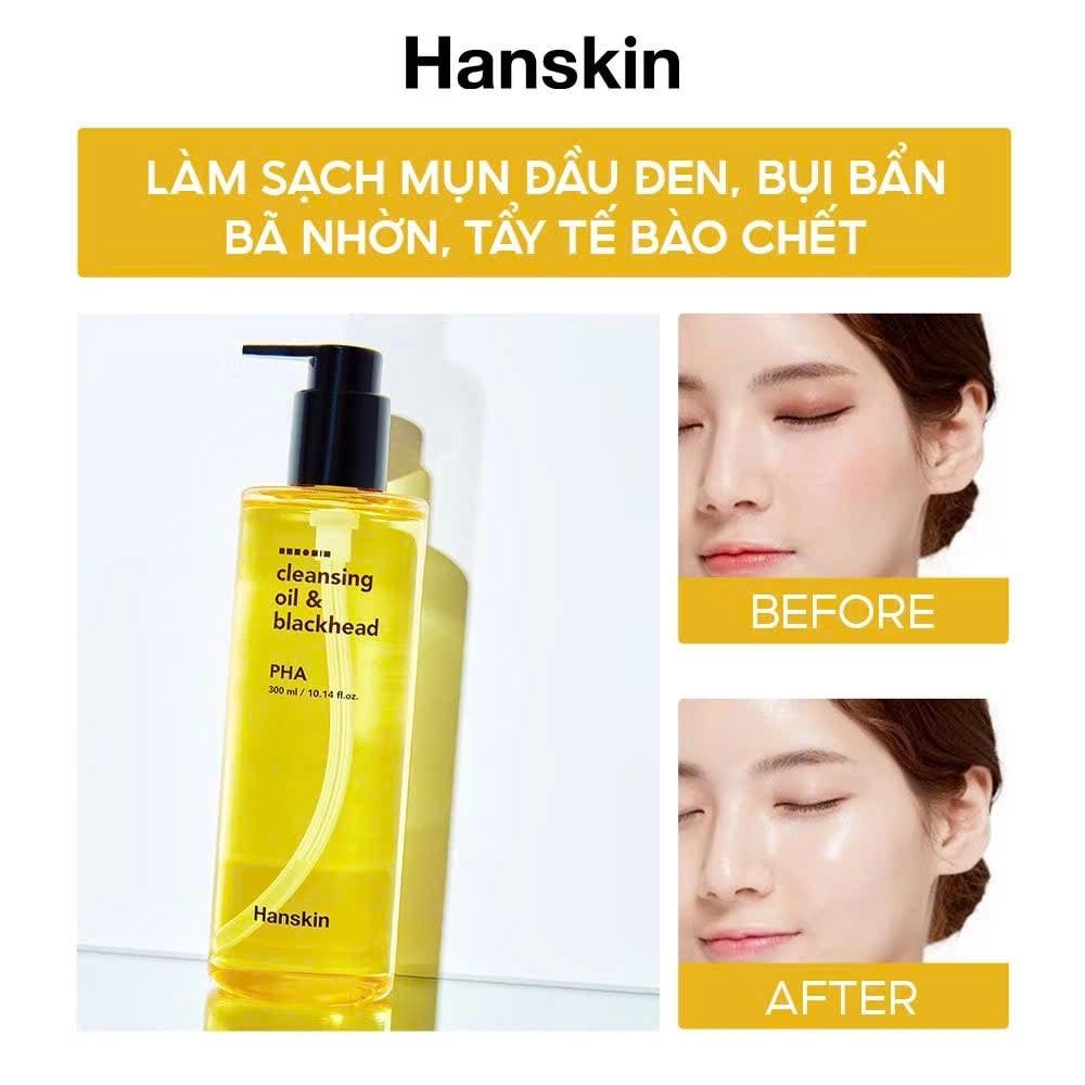 DẦU TẨY TRANG LÀM SẠCH SÂU HANSKIN CLEANSING OIL & BLACKHEAD