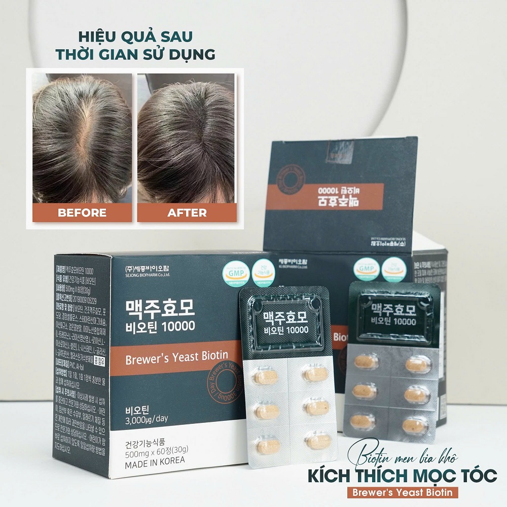 Thực phẩm Brewer's Yeast Biotin 10000