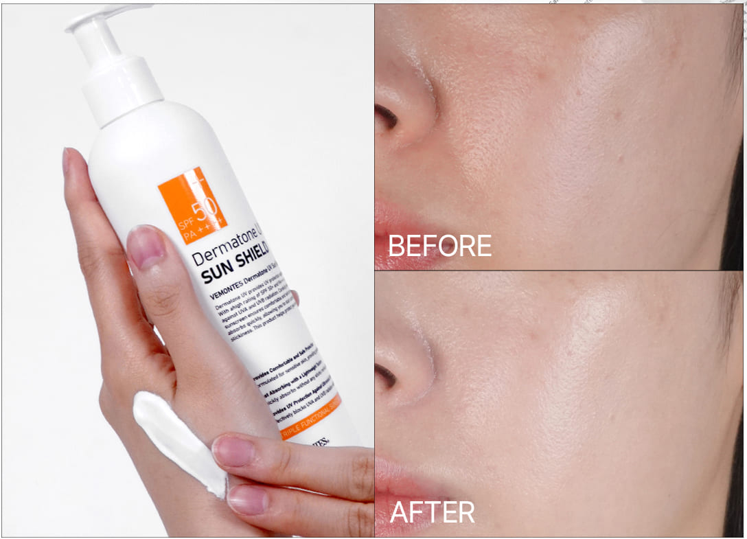 Kem chống nắng bảo vệ & Nâng tông - VEMONTES DERMATONE UV SUN SHIELD