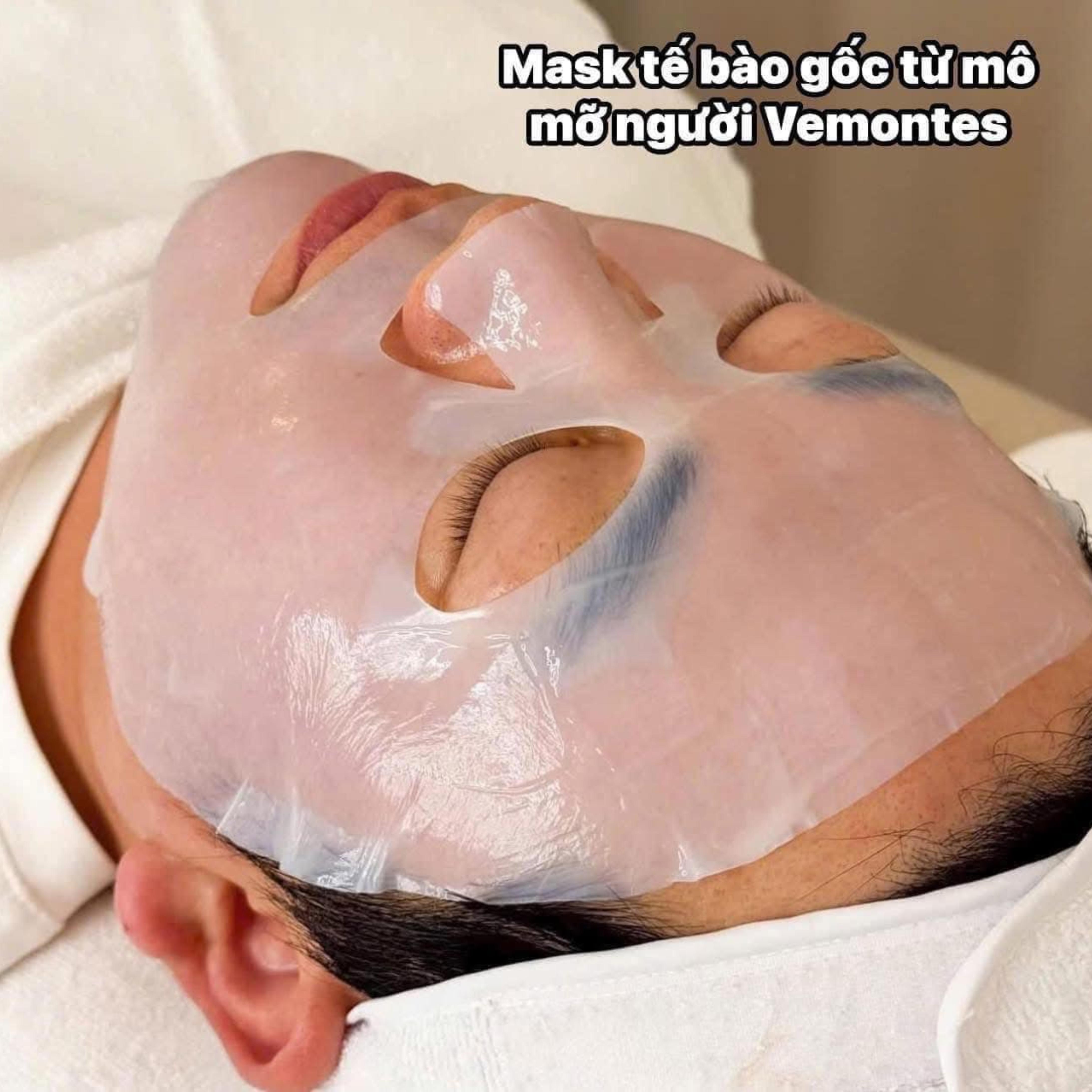 Mặt nạ tế bào gốc mô mỡ, phục hồi chuyên sâu & trẻ hóa làn da - VEMONTES EXOGAR PREMIUM TRASER MASK