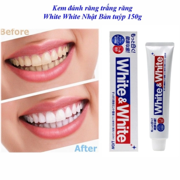 Kem đánh răng Lion White & White tuýp 150g