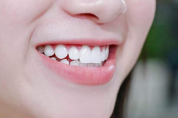 Chăm Sóc Răng Miệng Đúng Cách – Bí Quyết Cho Nụ Cười Khỏe Đẹp