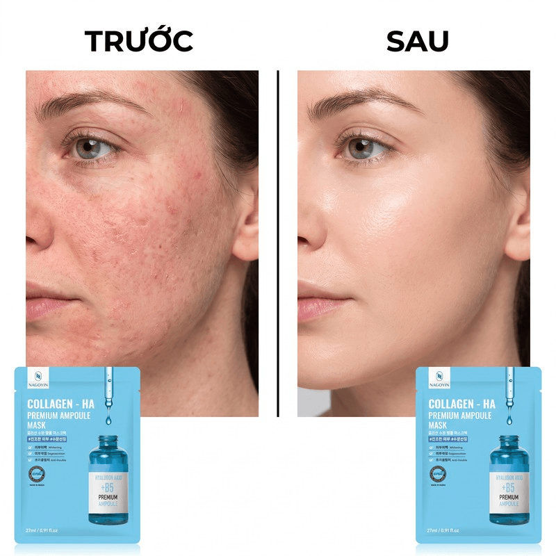 Mặt nạ NAGOYIN B5 cấp ẩm phục hồi