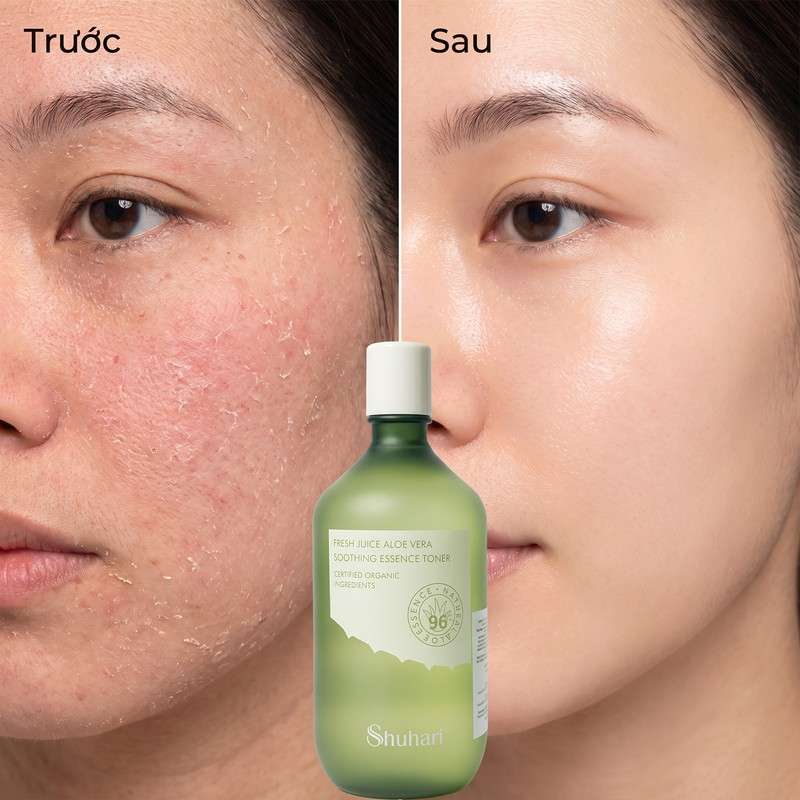 Nước hoa hồng SHUHARI nha đam tươi dưỡng sáng cân bằng độ ẩm 500ml