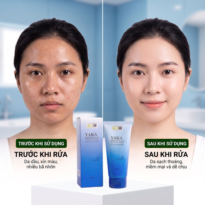 Sữa rửa mặt YAKA cho da mụn và bị đốm thâm 120ml
