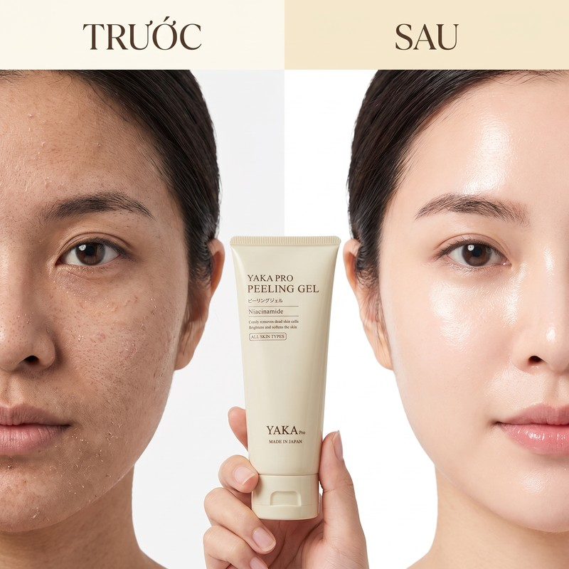 Gel tẩy tế bào chết YAKA PRO dưỡng sáng da tuýp
