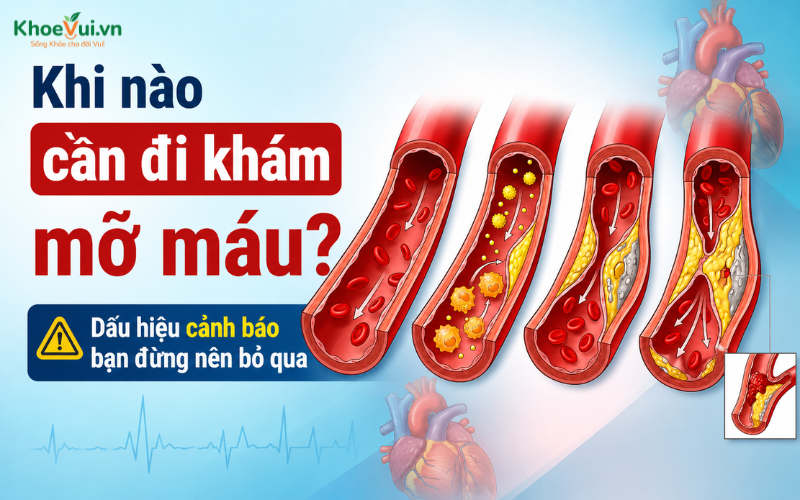 Khi nào cần đi khám mỡ máu? Dấu hiệu cảnh báo bạn đừng nên bỏ qua
