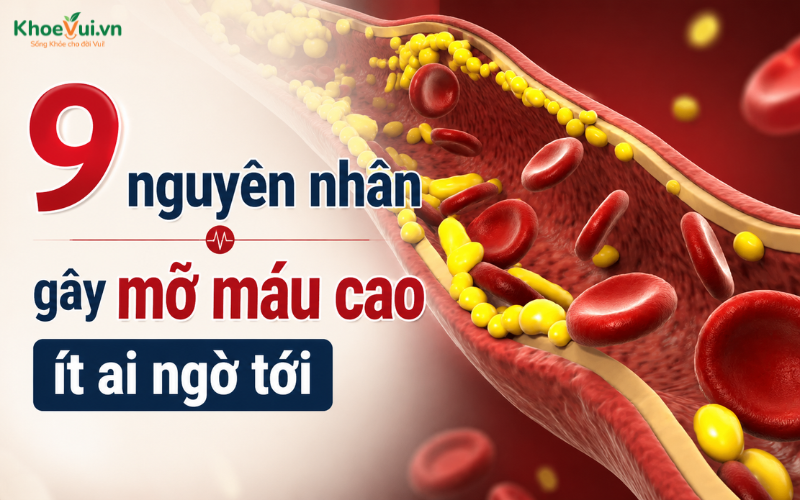 9 nguyên nhân gây mỡ máu cao ít ai ngờ tới