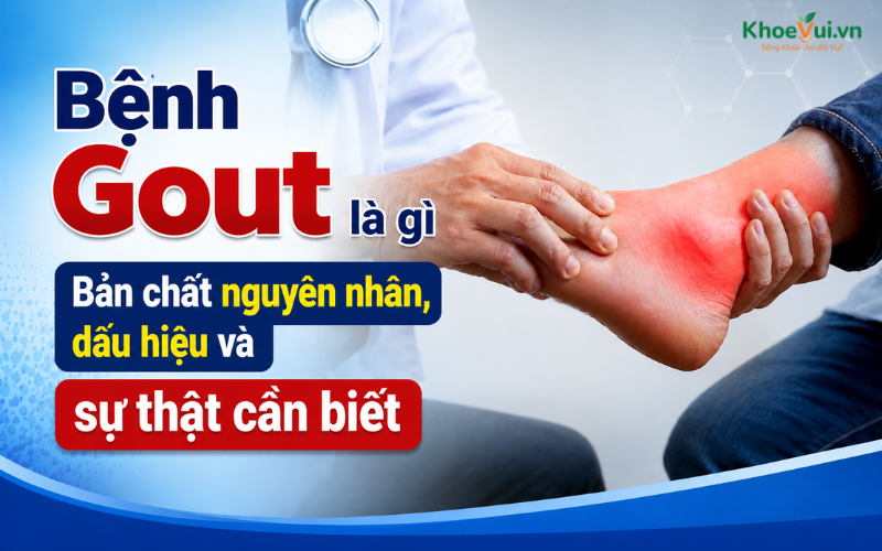 Bệnh Gout là gì: Bản chất nguyên nhân, dấu hiệu và sự thật cần biết