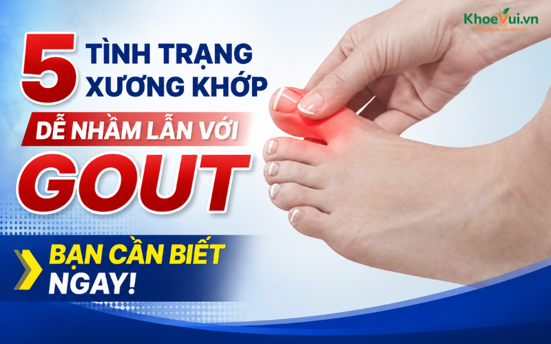5 tình trạng xương khớp dễ nhầm lẫn với Gout, bạn cần biết ngay!