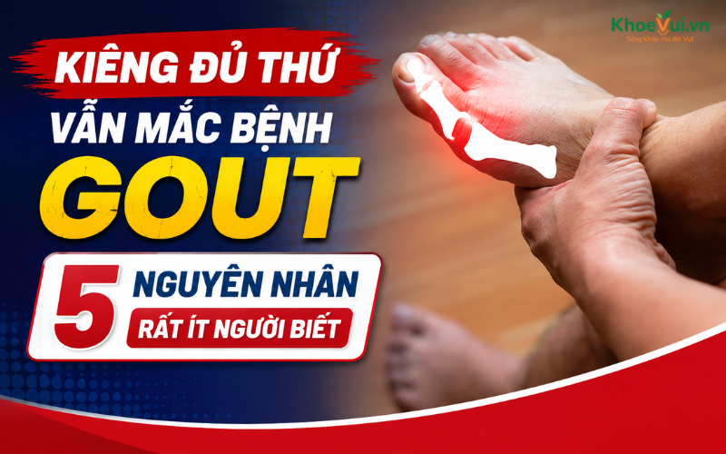 Kiêng đủ thứ vẫn mắc bệnh Gout: 5 nguyên nhân rất ít người biết