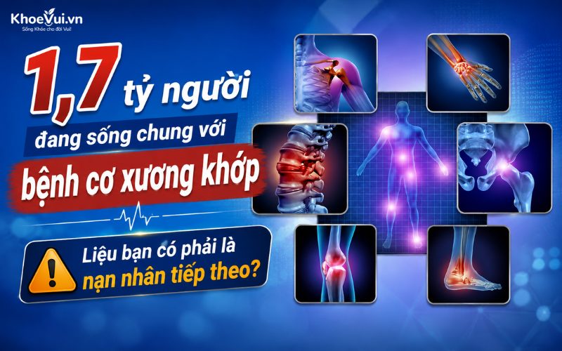 1,7 tỷ người đang sống chung với bệnh cơ xương khớp: Liệu bạn có phải là nạn nhân tiếp theo?