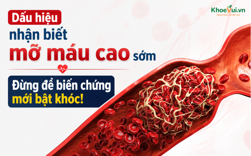 Dấu hiệu nhận biết mỡ máu cao sớm: Đừng để biến chứng mới bật khóc!