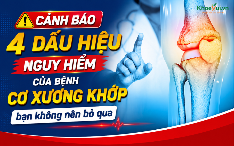 Cảnh báo 4 dấu hiệu nguy hiểm của bệnh cơ xương khớp bạn không nên bỏ qua