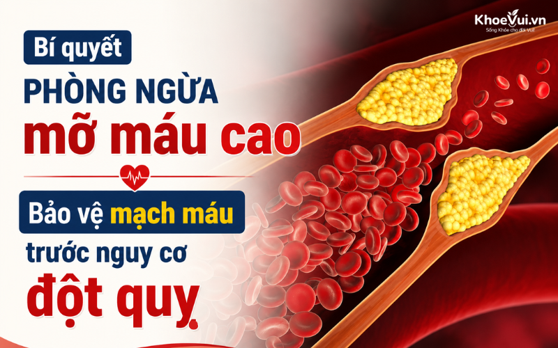 Bí quyết phòng ngừa mỡ máu cao: Bảo vệ mạch máu trước nguy cơ đột quỵ