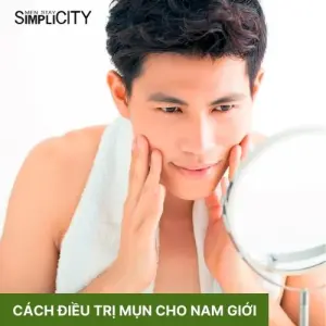 Cách điều trị mụn cho nam giới hiệu quả, dễ thực hiện