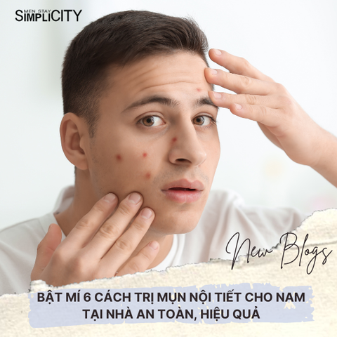 Bật mí 6 cách trị mụn nội tiết cho nam tại nhà an toàn, hiệu quả