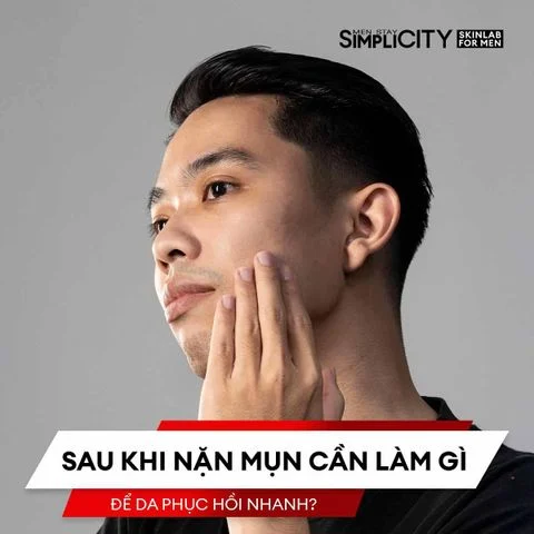 Sau khi nặn mụn cần làm gì để da phục hồi nhanh?