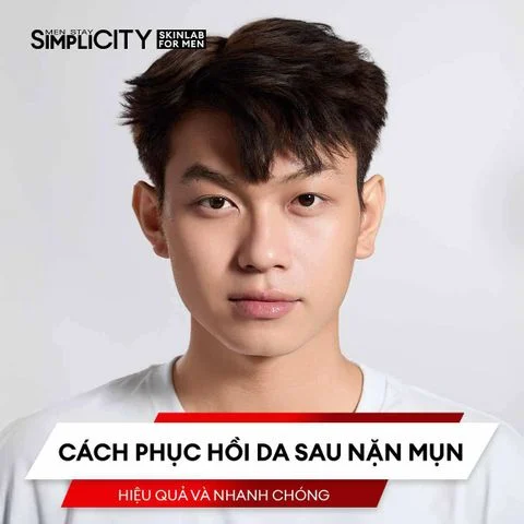 Cách phục hồi da sau nặn mụn hiệu quả và nhanh chóng