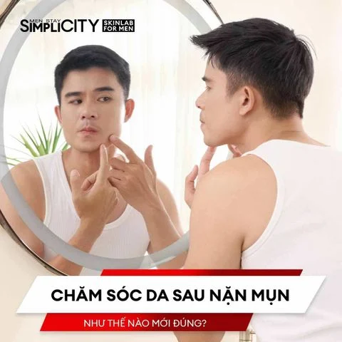 Chăm sóc da sau nặn mụn như thế nào mới đúng?