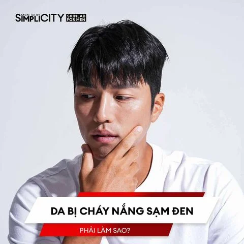 Da bị cháy nắng sạm đen phải làm sao?