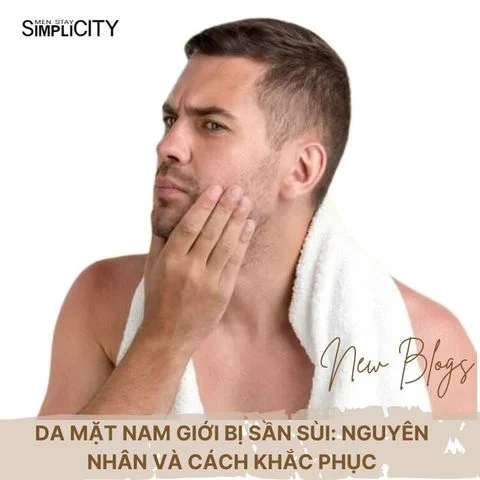 Da mặt nam giới bị sần sùi: Nguyên nhân và cách khắc phục