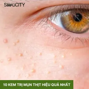 Điểm danh top 10 kem trị mụn thịt được bác sĩ khuyên dùng năm 2026