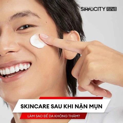 Skincare sau khi nặn mụn: Làm sao để da không thâm?