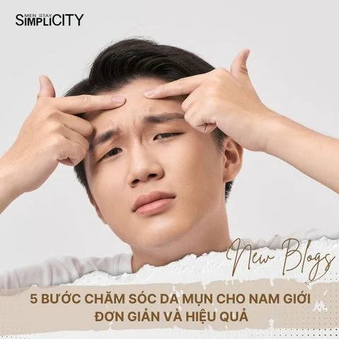 5 Bước Chăm Sóc Da Mụn Cho Nam Giới Đơn Giản Và Hiệu Quả