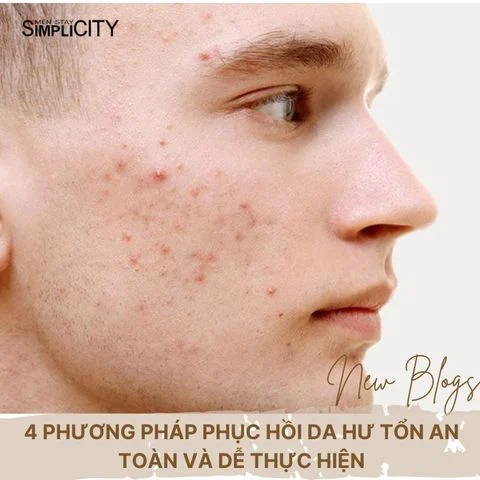 4 phương pháp phục hồi da hư tổn an toàn và dễ thực hiện