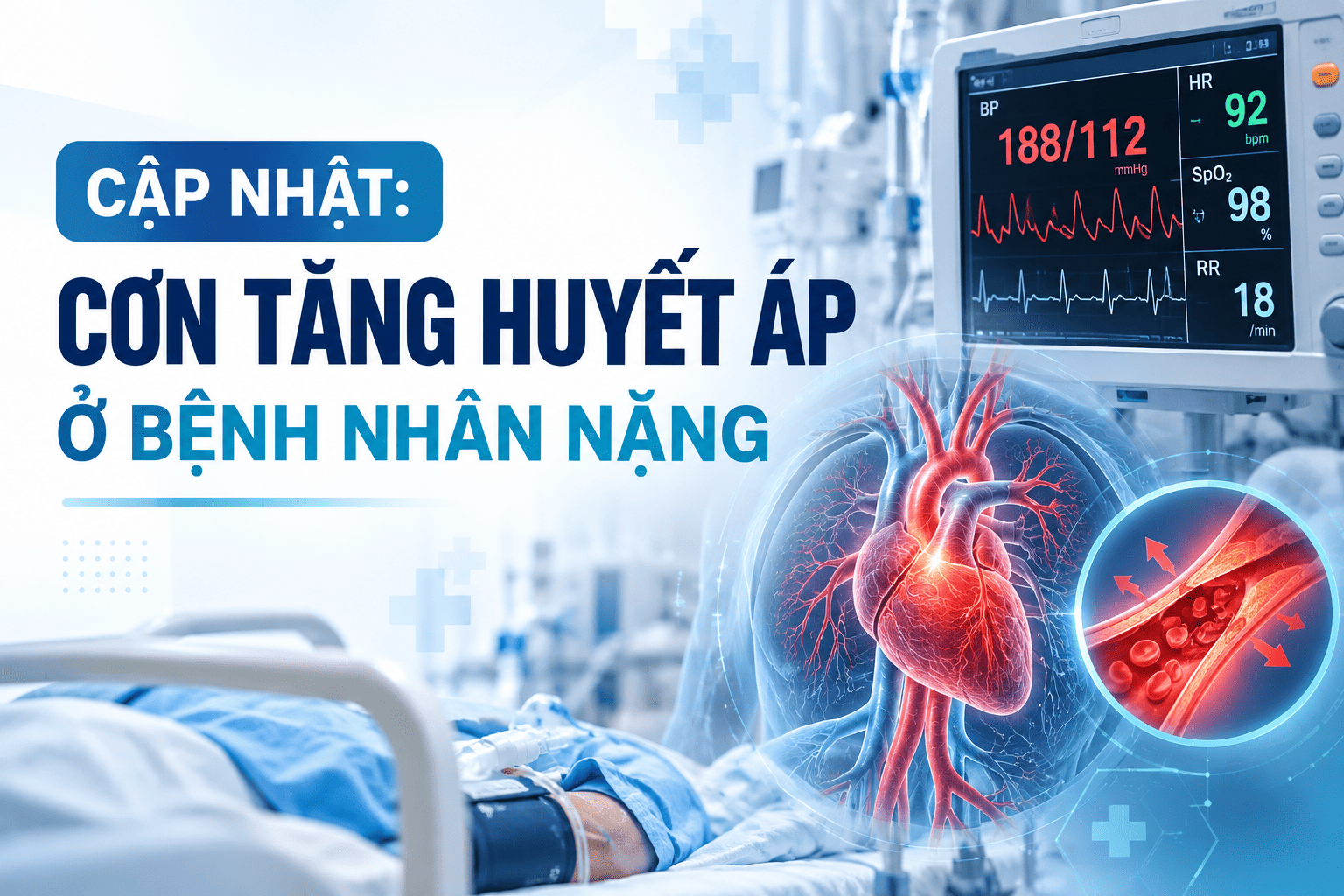 Cập nhật: Cơn tăng huyết áp ở bệnh nhân nặng