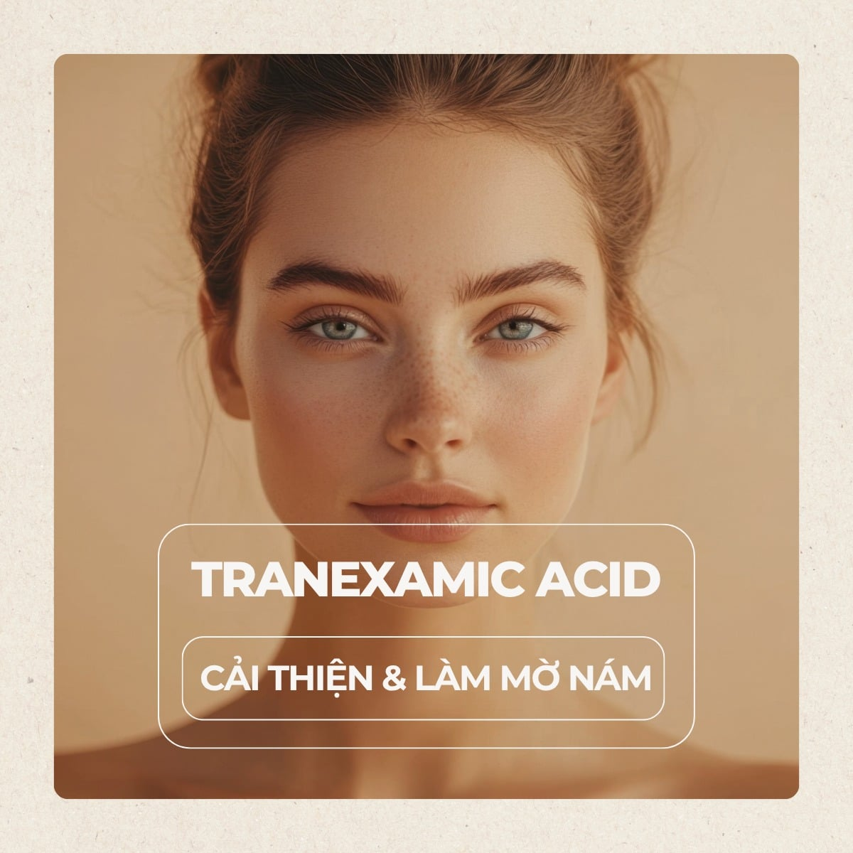 TRANEXAMIC ACID - 