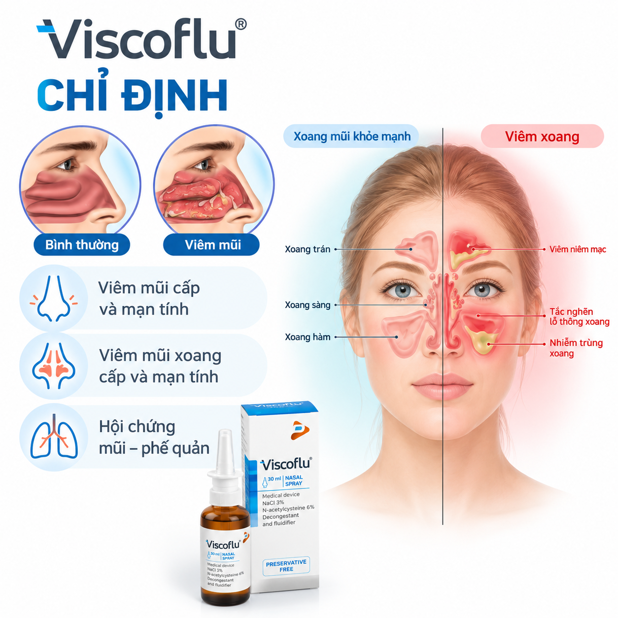 Xịt mũi Viscoflu® Nasal Spray 30 mL – Hỗ trợ làm loãng dịch nhầy, thông thoáng đường mũi
