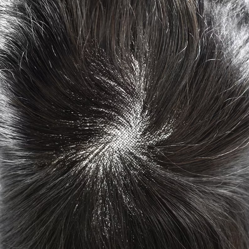 Tóc Giả Nam Che Hói - Kiểu Quiff Bằng Tóc Thật | Wina