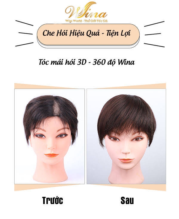 Mái Thưa Phủ Đỉnh 3D Xoáy Bằng Tóc Thật 30cm