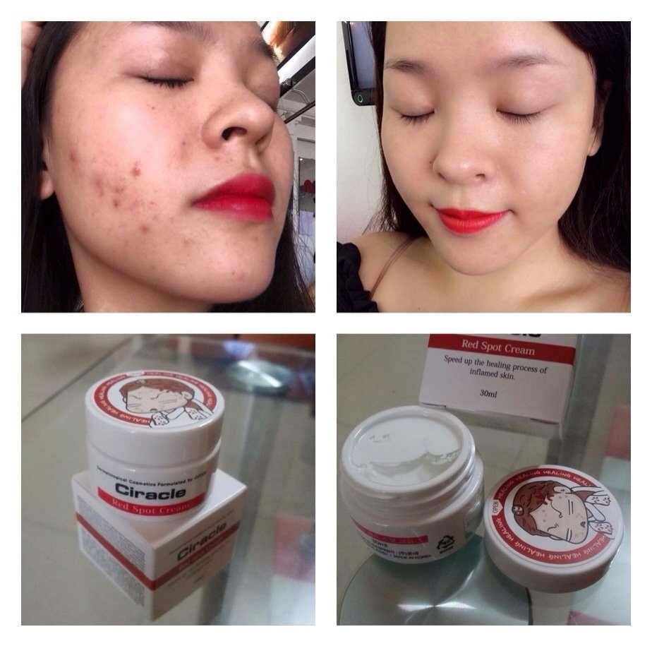 red spot cream