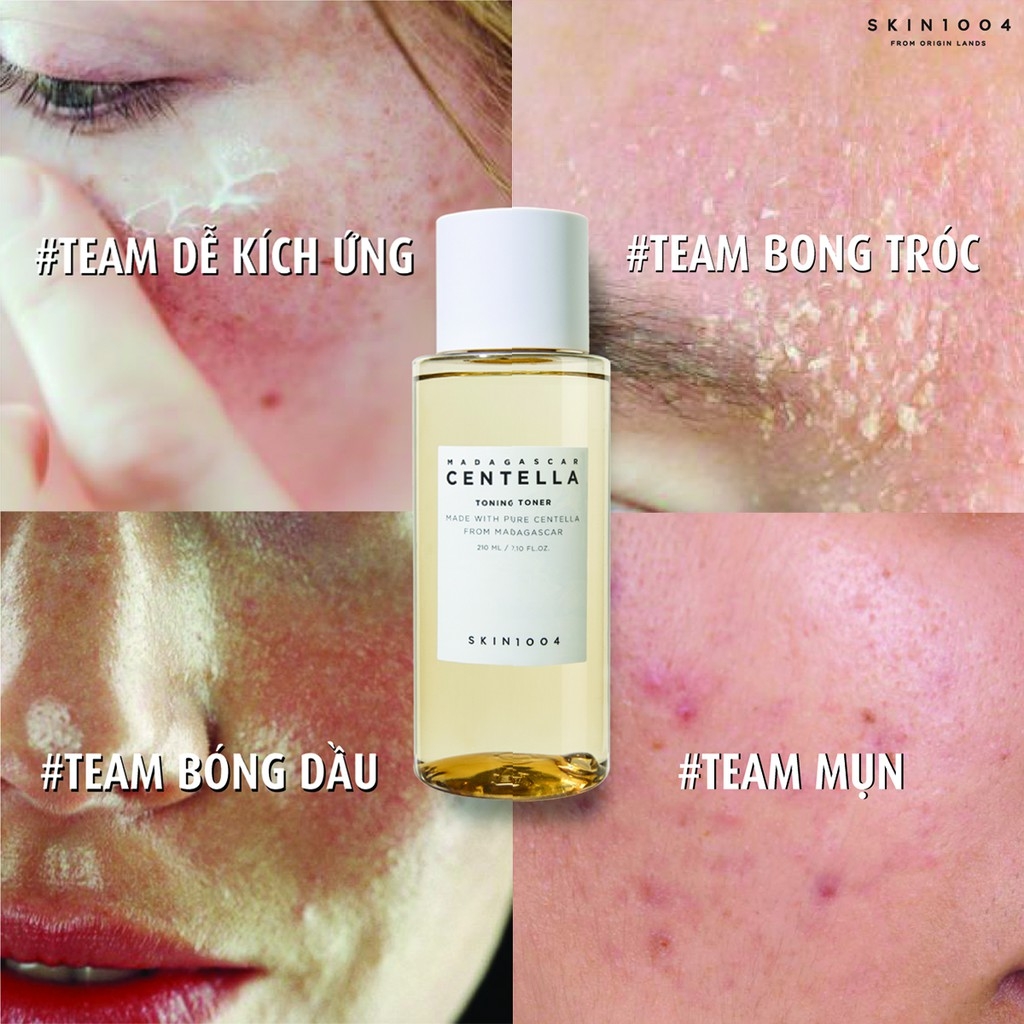 [KHÔNG VÒI PUMBU] Tinh Chất Rau Má Giảm Mụn Skin1004 Madagascar Centella Asiatica Ampoule 30ml 
